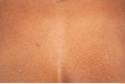 Photo Textures of Human Skin